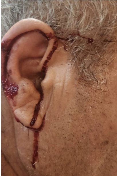 צילום מרשתות חברתיות לפי סעיף 27 א&#39;